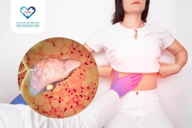 8 câu hỏi về bệnh gan nhiễm mỡ (NAFLD) mà bạn cần biết