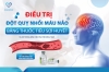Điều trị đột quỵ nhồi máu não bằng thuốc tiêu sợi huyết tại hệ thống Bệnh viện Tâm Trí Đồng