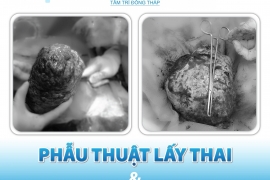 Phẫu thuật lấy thai cho sản phụ đồng thời loại bỏ khối u xơ tử cung nặng 2,5kg