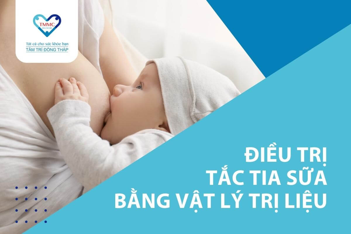 Điều trị tắc tia sữa bằng phương pháp vật lý trị liệu