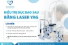 Điều trị đục bao sau bằng Laser YAG