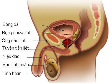 Phòng tránh ung thư tiền liệt tuyến như thế nào là hiệu quả?