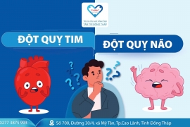 Sự khác biệt giữa đột quỵ não và đột quỵ tim