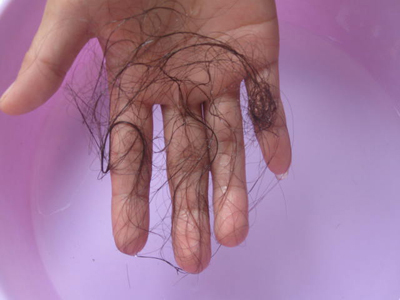 Những dấu hiệu lạ trên cơ thể giúp bạn phát hiện bệnh ung thư trước vài năm