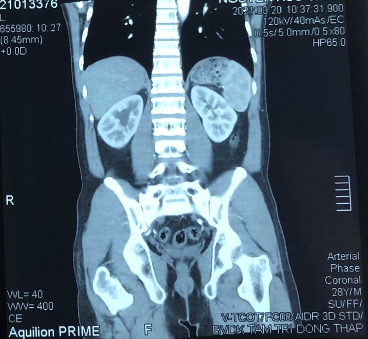 hinh-ct-scanner