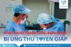 Phẫu thuật thành công bệnh nhân bị ung thư tuyến giáp