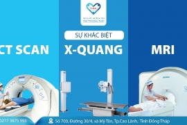 Sự khác biệt giữa chụp Mri, CT Scan và X-Quang: Chỉ định và ứng dụng lâm sàng