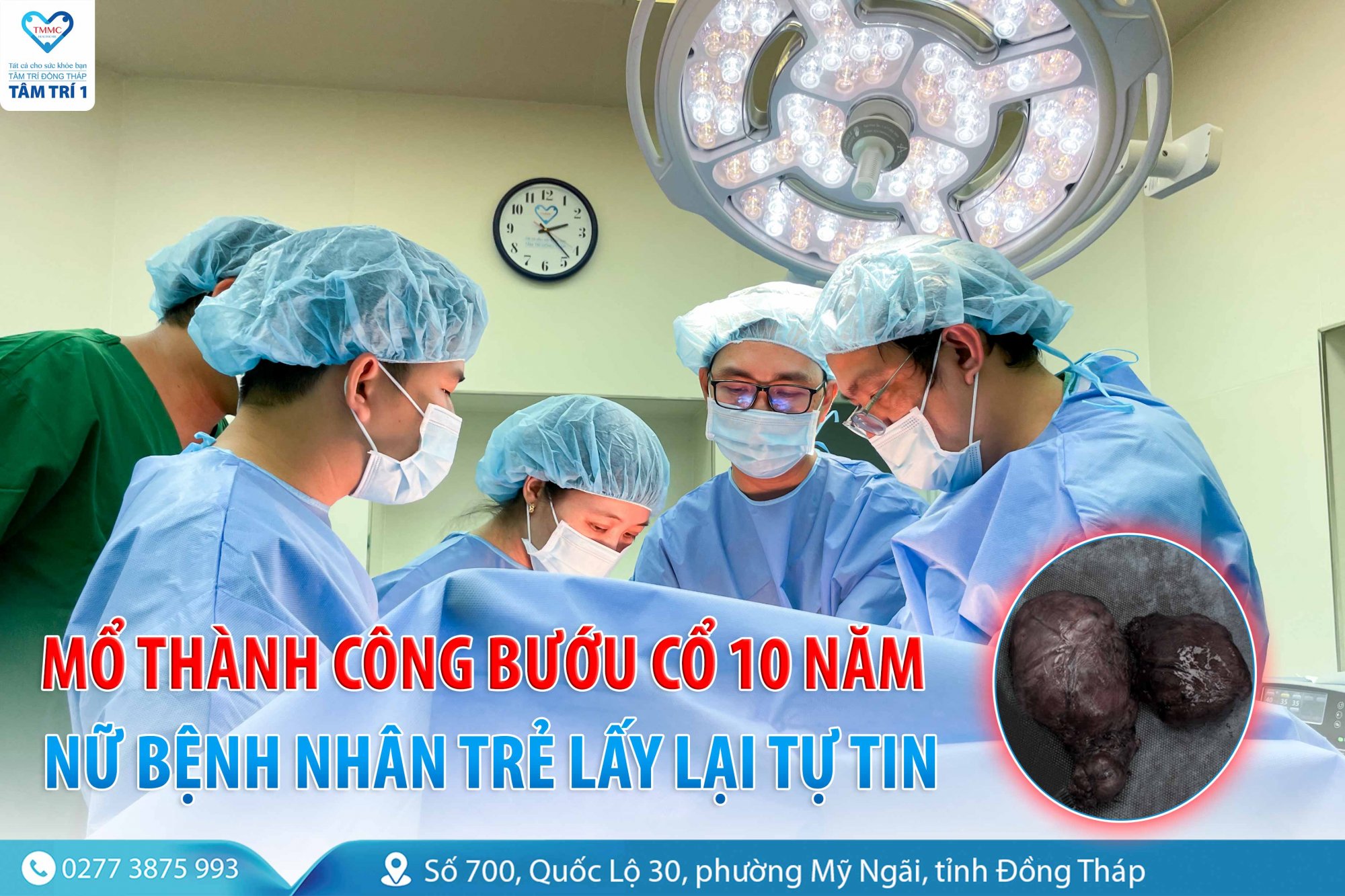 Mổ thành công bướu cổ 10 năm – nữ bệnh nhân trẻ lấy lại tự tin