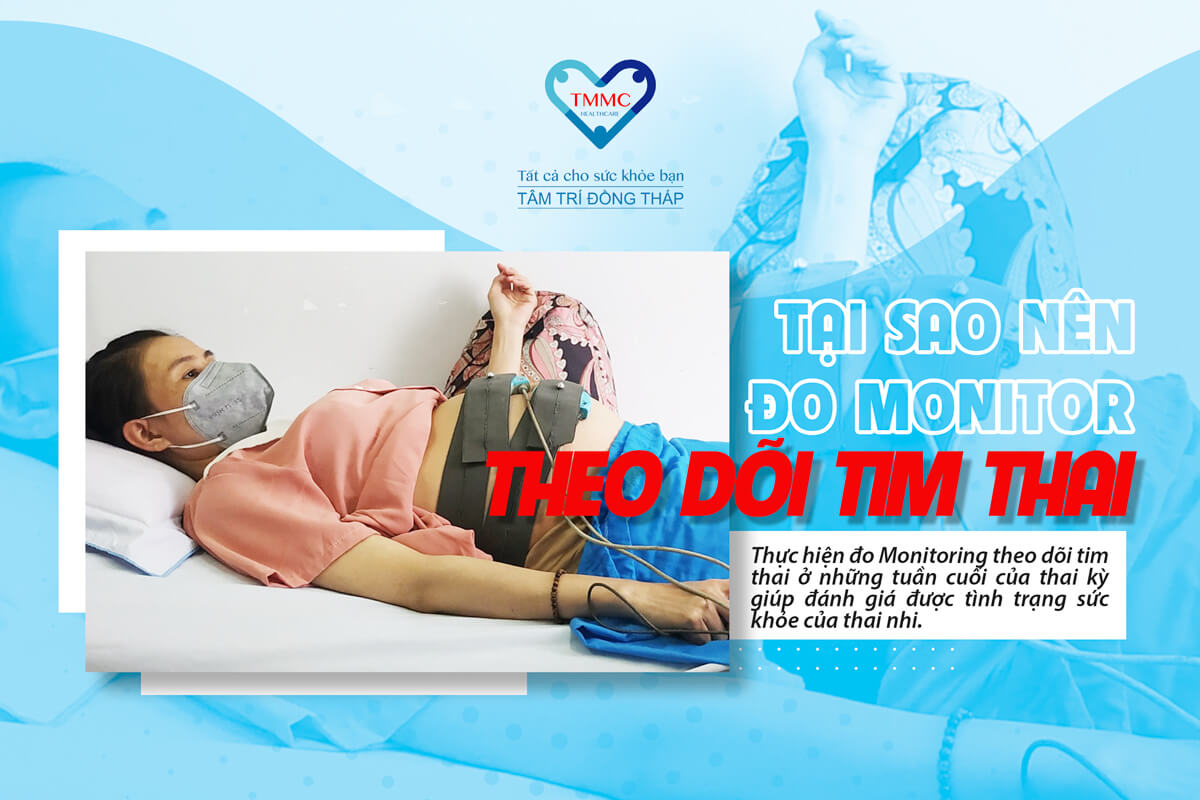 Đo tim thai Monitoring là gì? Tại sao cần phải theo dõi tim thai?