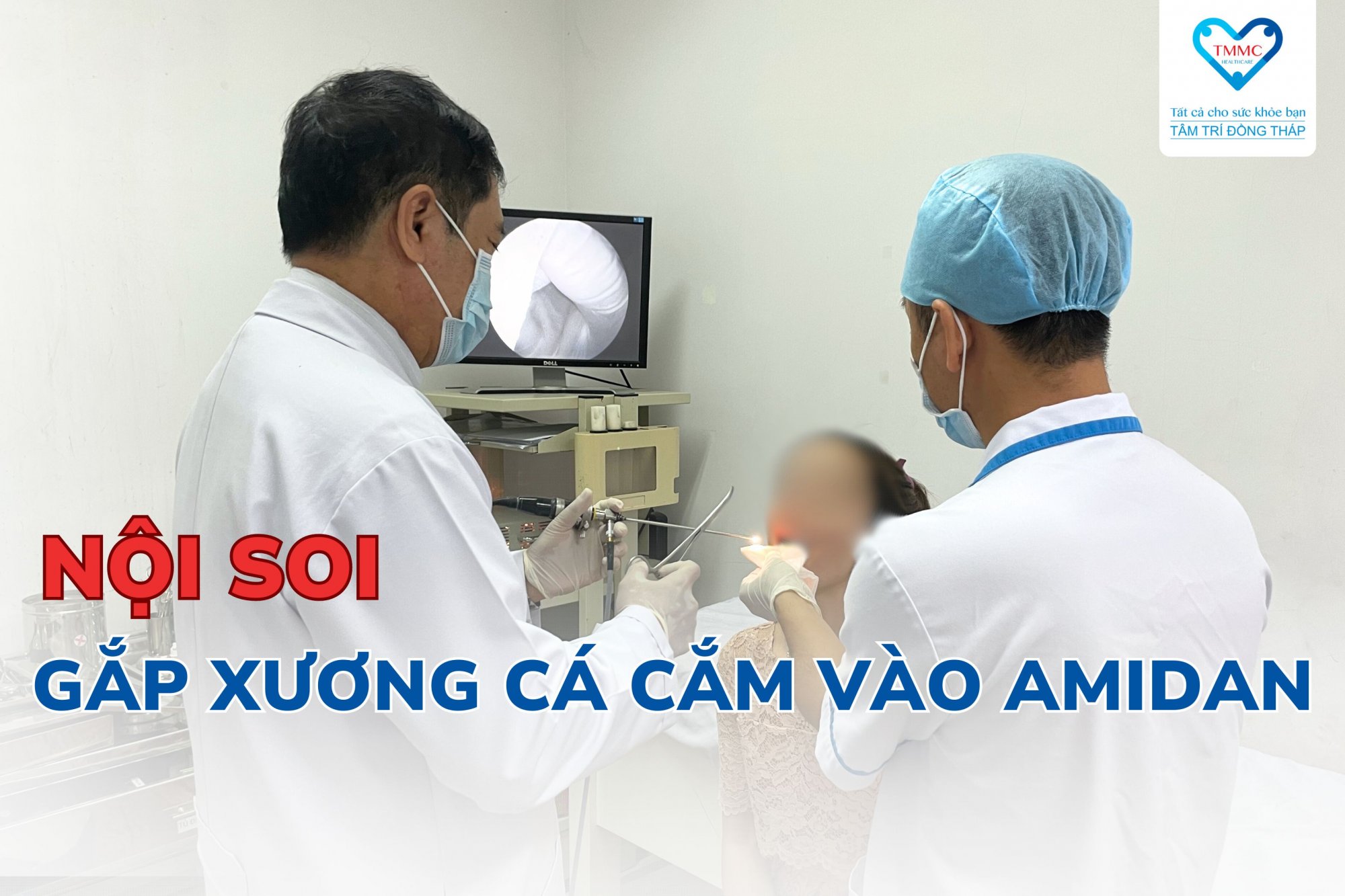 Nội soi gắp xương cá cắm vào amidan