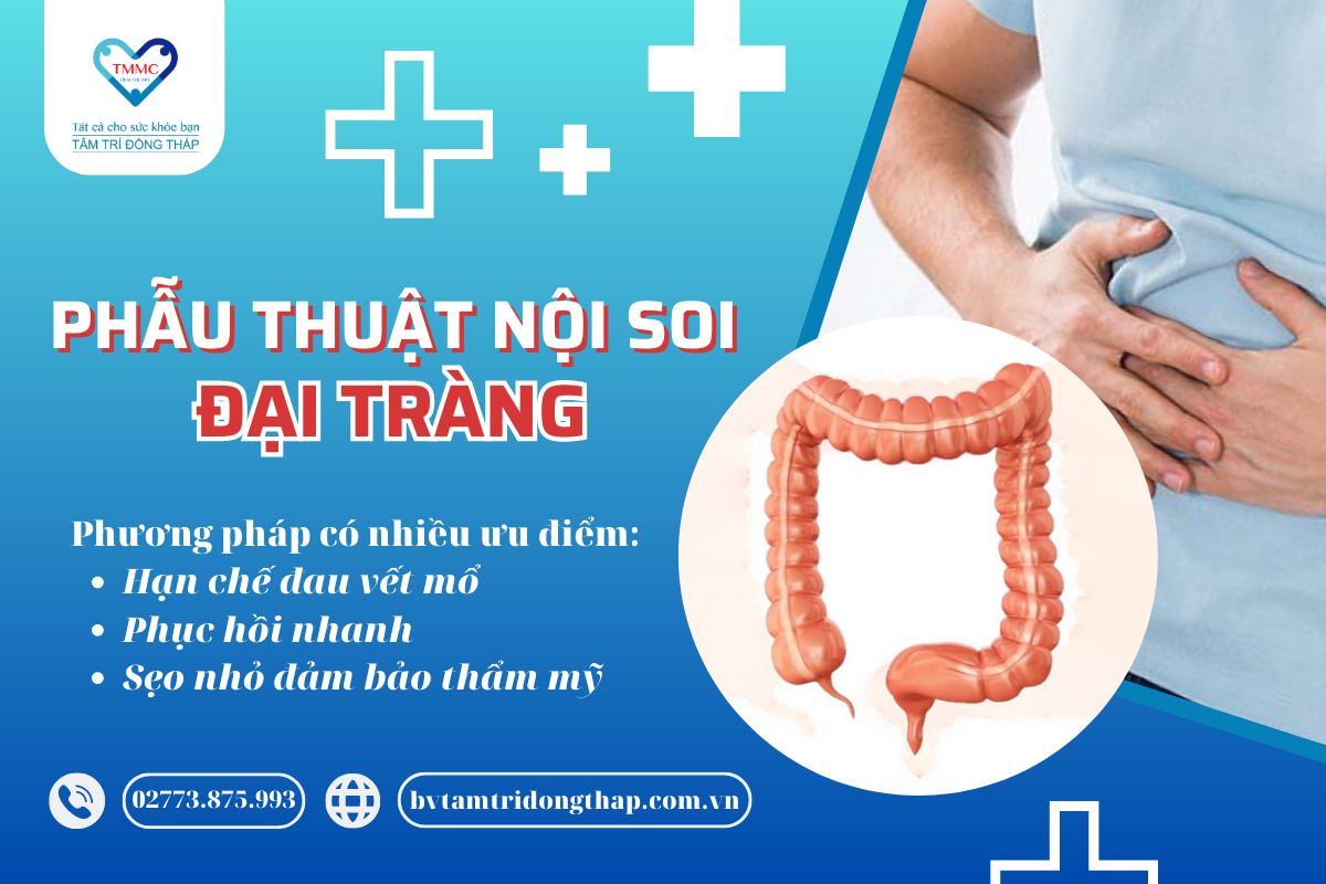 Phẫu thuật nội soi đại tràng tại Bệnh viện Tâm Trí Đồng Tháp