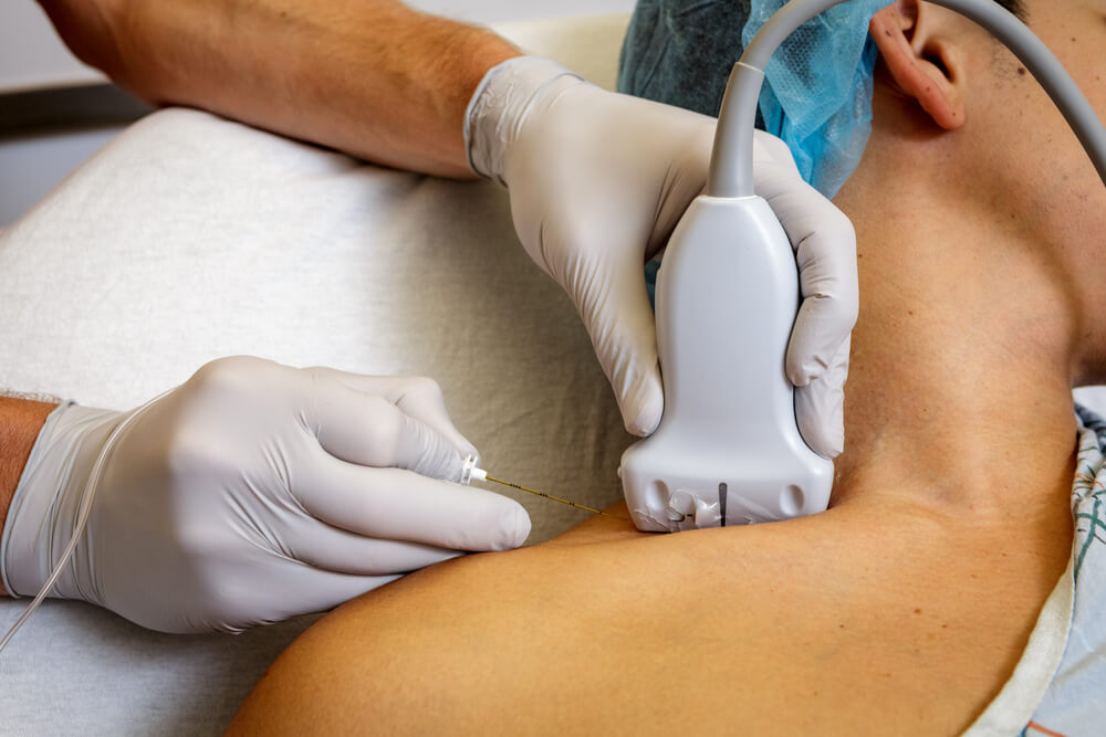 Phong bế thần kinh ngoại biên dưới hướng dẫn siêu âm để phẫu thuật