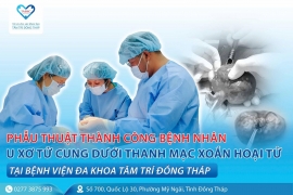 Phẫu thuật thành công bệnh nhân u xơ tử cung dưới thanh mạc xoắn hoại tử 