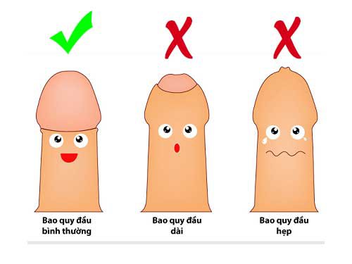 Có nên cắt bao quy đầu cho trẻ? Độ tuổi nào thích hợp để cắt?