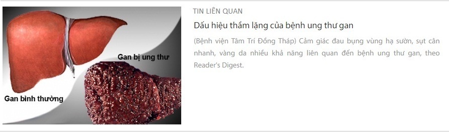 ung-thu-gan_2