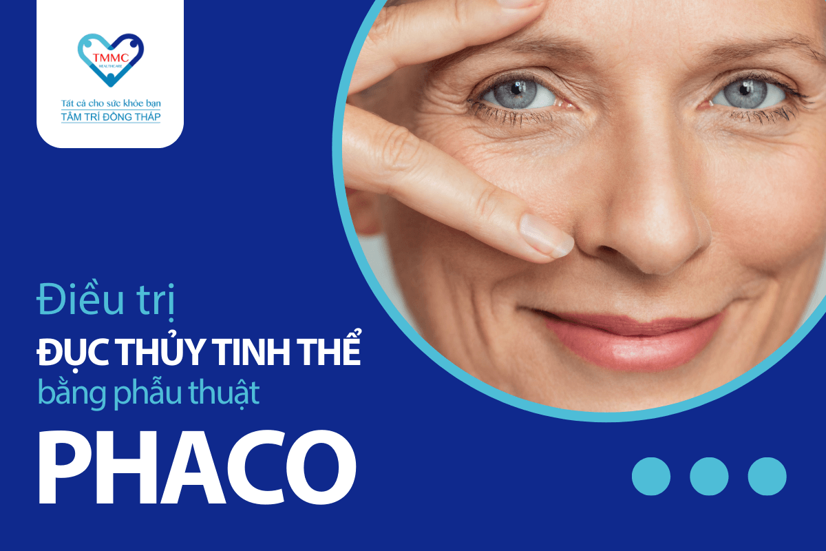 Điều trị đục thủy tinh thể bằng phẫu thuật mắt Phaco tại Tâm Trí Đồng Tháp