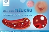 Bệnh giảm tiểu cầu và những điều cần biết