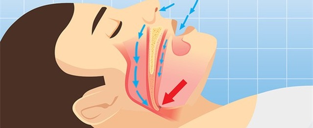 6 bệnh gần như không có triệu chứng rõ ràng ban đầu, khi phát hiện ra thì đã nặng