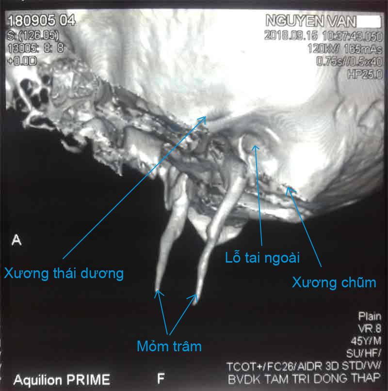 momtram-ctscan-web_1