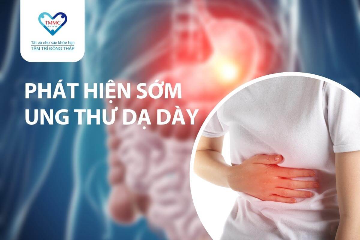 Cách phát hiện sớm ung thư dạ dày ngay từ giai đoạn đầu