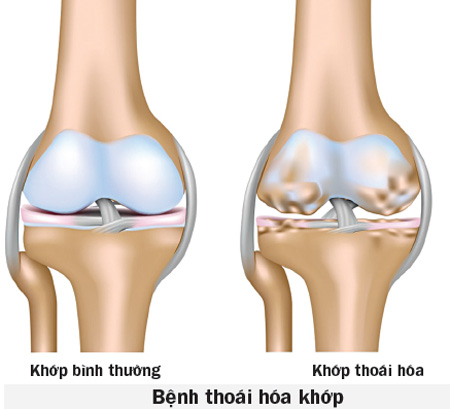 dv-co-xuong-khop-1