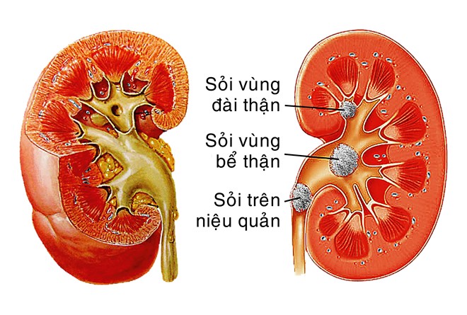 dv-soi-than-1