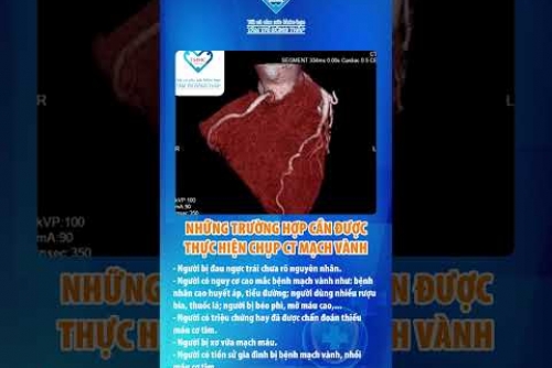 Chụp CT mạch vành - Tầm soát nguy cơ bệnh nhồi máu cơ tim
