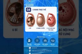  Phẫu thuật nội soi trong điều trị u nang buồng trứng