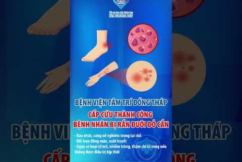 Cấp cứu thành công bệnh nhân bị rắn lục đuôi đỏ cắn