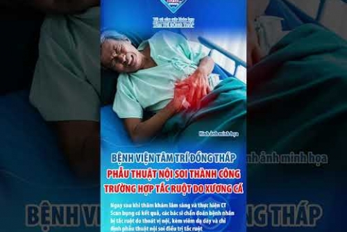 Tâm Trí Đồng Tháp phẫu thuật nội soi thành công trường hợp tắc ruột do xương cá 